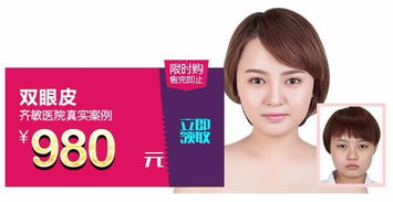 鞍山齊敏 980元雙眼皮手術，開啟美麗雙眸新篇章